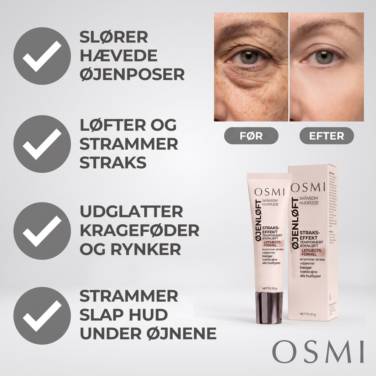 Slører hævede øjenposer