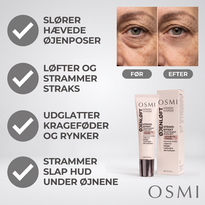 Slører hævede øjenposer
