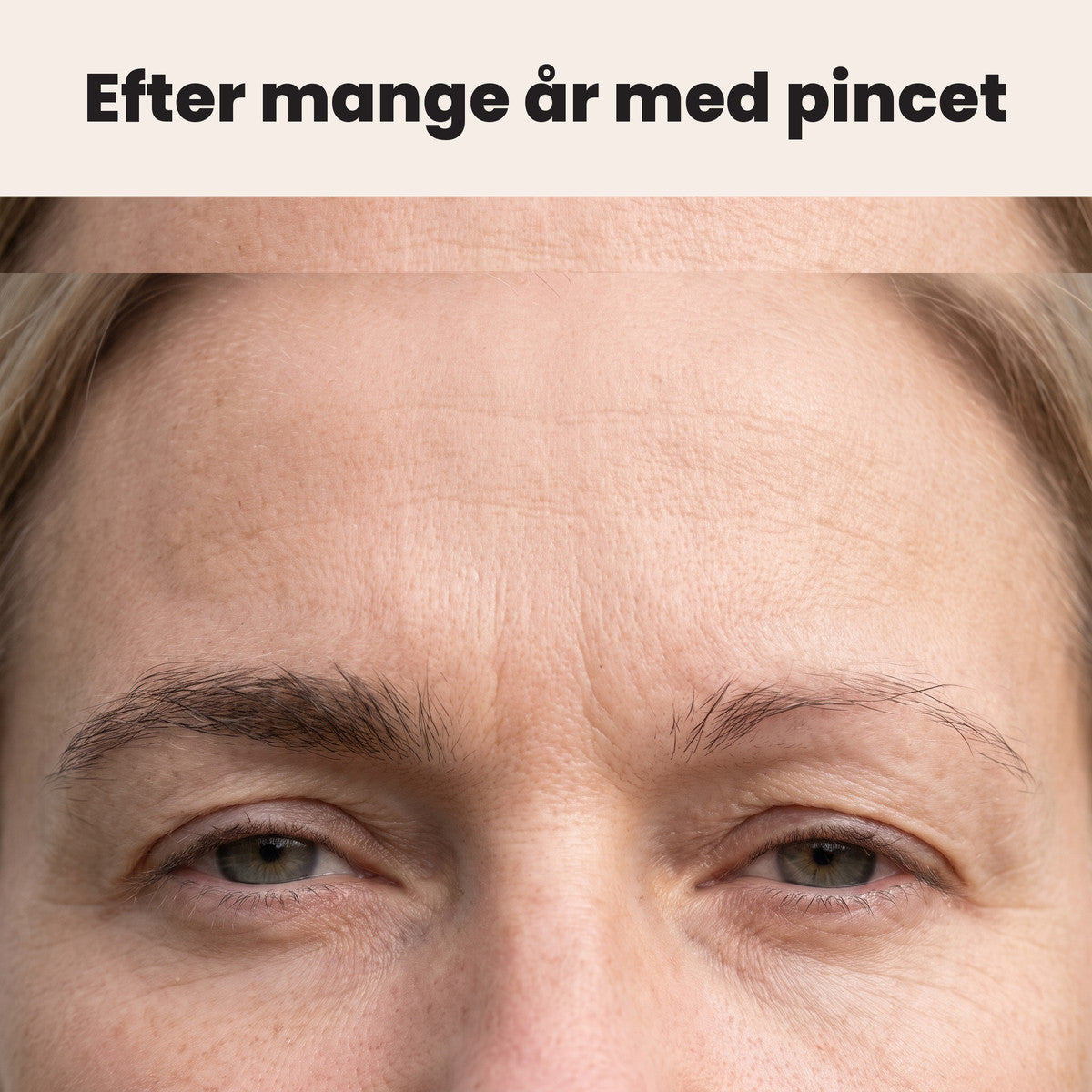 Bryn efter mange år med pincet
