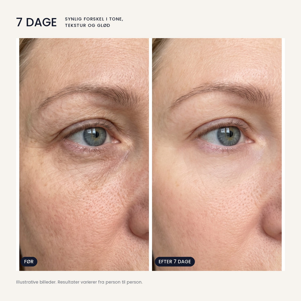 OSMI® Advanced Renewal Serum – bioexosomer & PDRN
