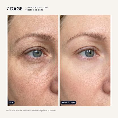 OSMI® Advanced Renewal Serum – bioexosomer & PDRN