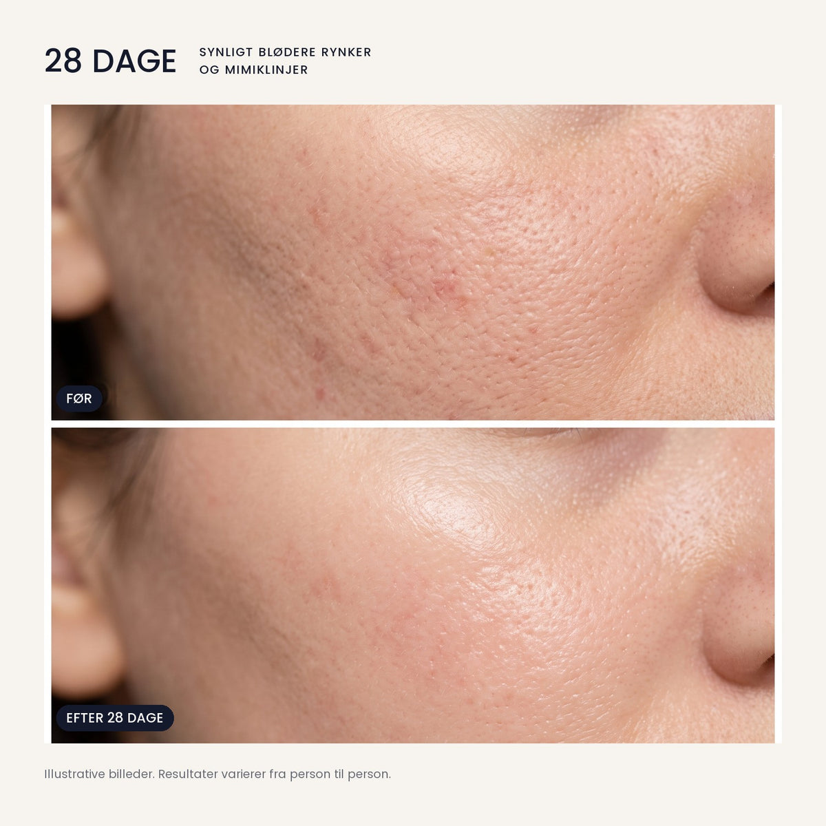OSMI® Advanced Renewal Serum – bioexosomer & PDRN