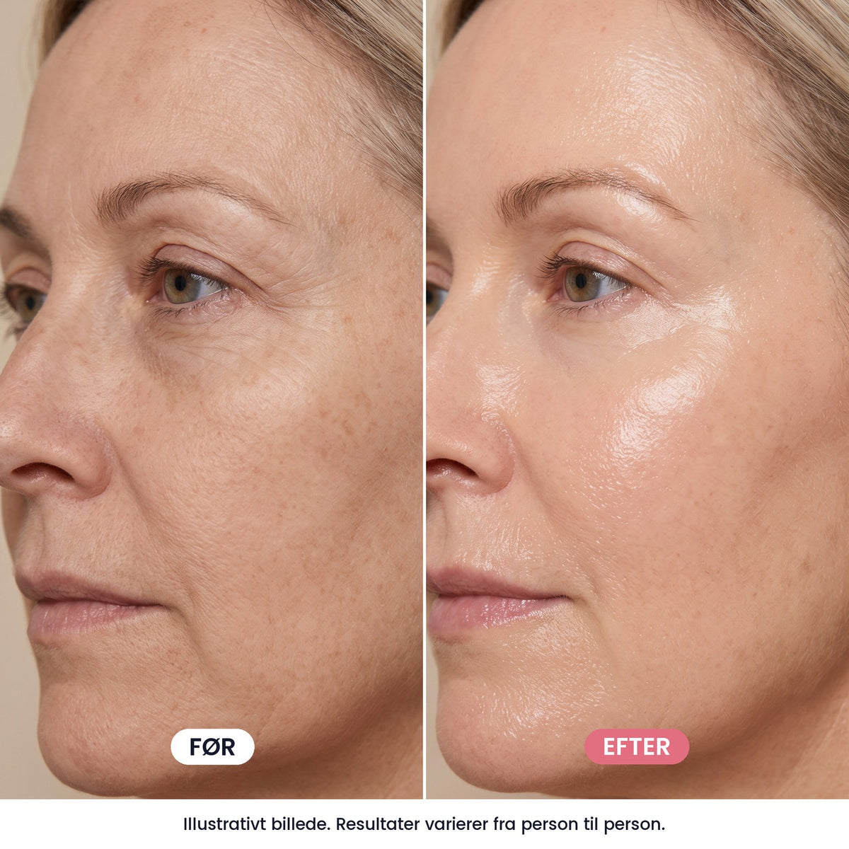 OSMI® Collagen Mask – koreansk peel-off-maske med kollagen