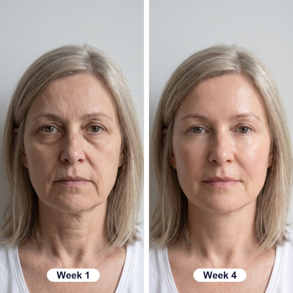 Week 1 and week 4 with OSMI Collagen Volume Serum